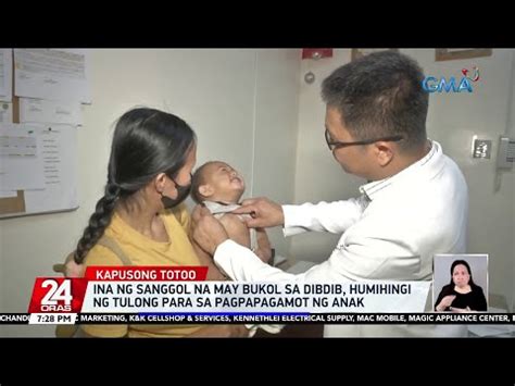 Ina Ng Sanggol Na May Bukol Sa Dibdib Humihingi Ng Tulong Para Sa