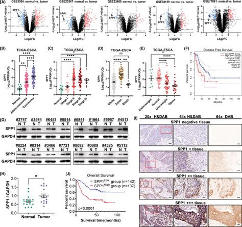 Overexpression Of Spp Is Associated With Poor Prognosis In Esca A