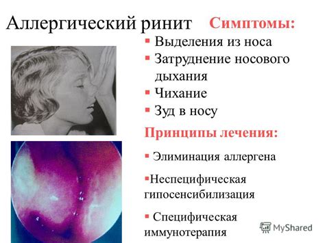 Презентация на тему: "Патология носа и околоносовых пазух у детей ...