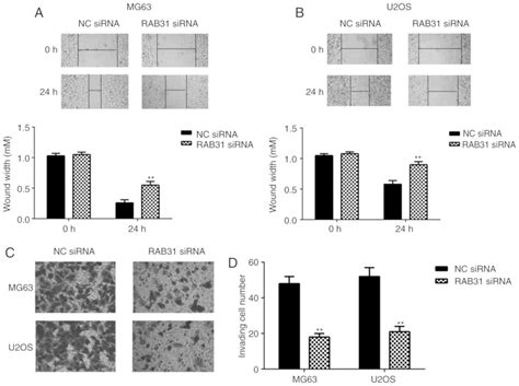 RAB31 is targeted by miR-26b and serves a role in the promotion of ...
