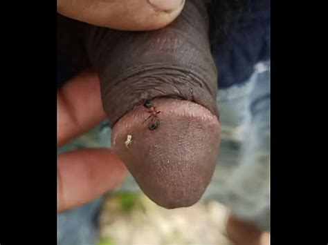Ant Bite My Penice Xvideos