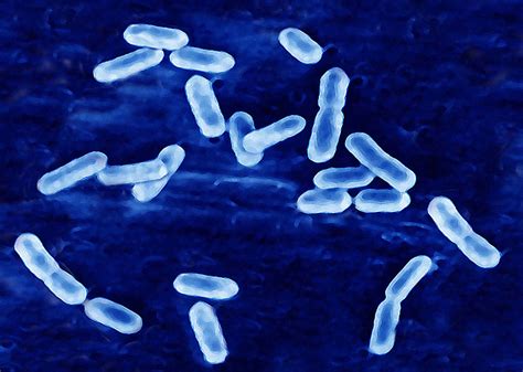 Листериоз - инфекционное заболевание