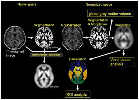 Schema Of Brain Mr Image Analysis For Global And Regional Gray Matter