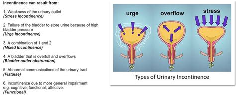 Urinary Incontinence Geriatric Primary Care