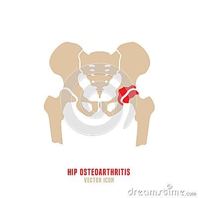 Hip Osteoarthritis Icon Cartoon Vector CartoonDealer 143594567