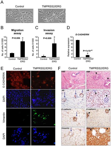 Tmprss2 Erg Promotes Emt In Prostate Epithelial Cells A For Download Scientific Diagram