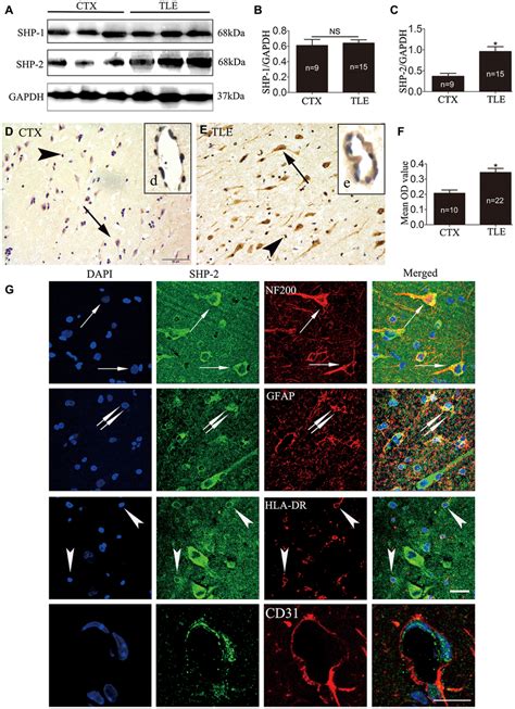 The Expression Pattern Of Shp‐12 In The Temporal Neocortex Of Patients