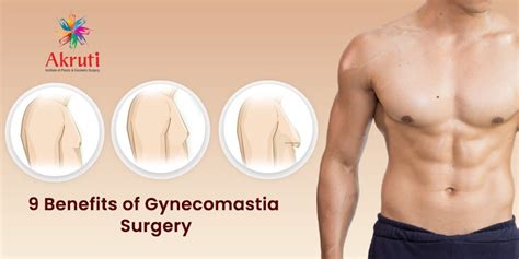 9 Benefits Of Gynecomastia Surgery Akruti