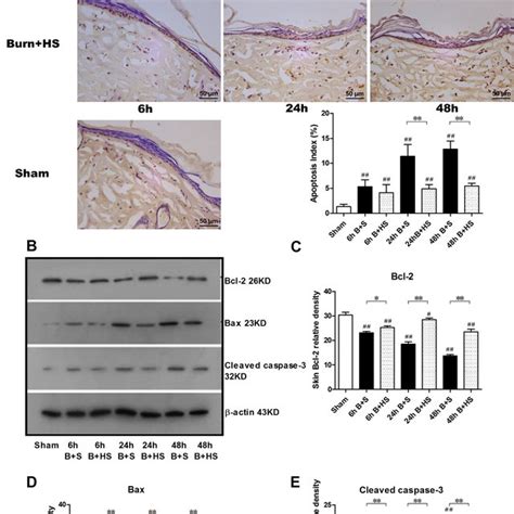 Western Blot Analysis Of Inflammatory Cytokines In Wound Interspaces