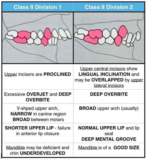 Class Ii Division 1 Vs Division 2 Dental Hygiene School Dental Hygienist Dental