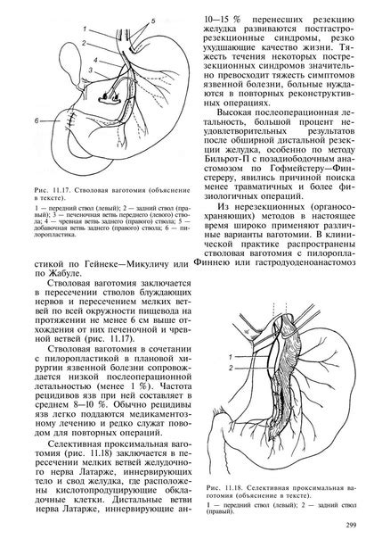 Кузин М.И. (ред.) Хирургические болезни 3-е изд., перераб. и доп. — М ...