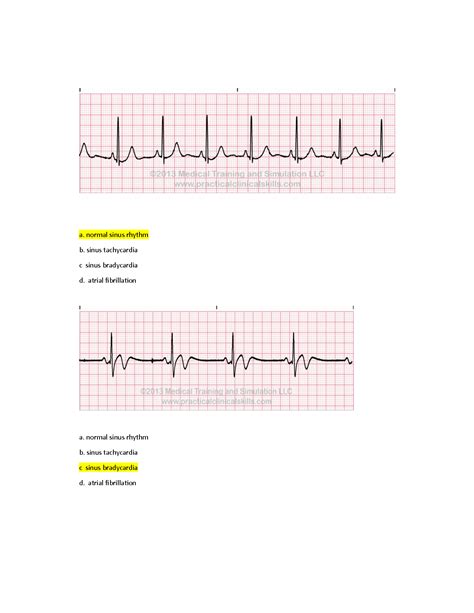 Solution Ekg Assignment Worksheet Studypool