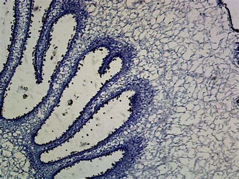 Gsc International Ps0112 Coprinus Mushroom Anatomy Basidiomycetes