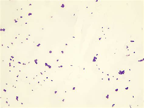 Micrograph Staphylococcus Aureus Gram Stain 1000x P000028 Oer Commons