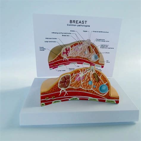 Kyrenmed Female Breast Pathological Anatomy Model Breast Structure