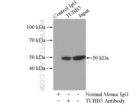 Beta Tubulin Antibody 66240 1 Ig Proteintech