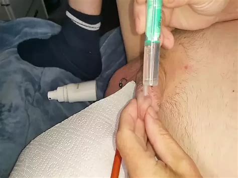 Xh Handy Mein Intestinal Tube In The Dick From 19 06 22 Gay Amateur Amateur Porn XHamster