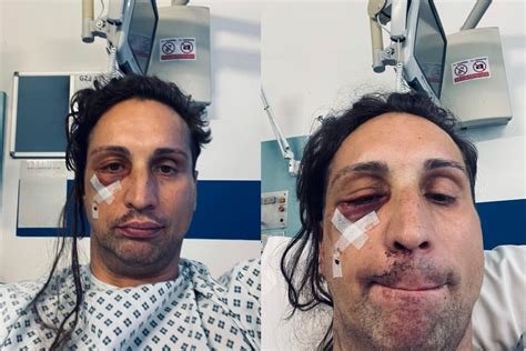 Gay Man Afraid To Leave His House After Being Hit With Hammer In Brutal Homophobic Hate Crime