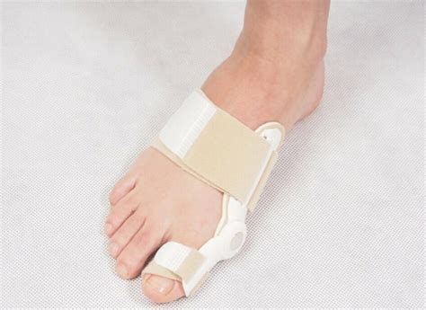 Халюс Вальгус (Hallux valgus): степени, МКБ-10, операция и лечение