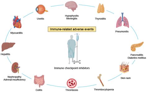 Ijms Free Full Text Rheumatic Immune Related Adverse Events Due To