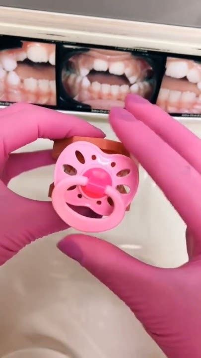 Dente De Crianca Que Chupa Bico - 🦷 Dentes de Criança Que Usa Chupeta 🦷 - YouTube
