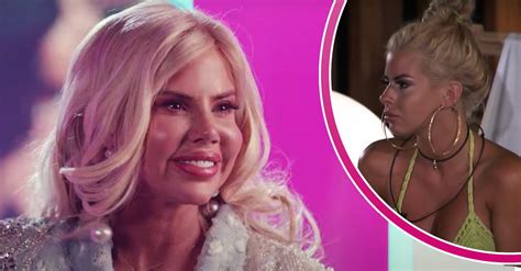 Love Island star Hannah Elizabeth and her numerous surgeries