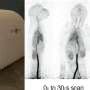 Human Images From World S First Total Body Scanner Unveiled