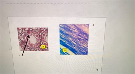 Solved 5 Pages 5-8: Tissue ID Be very specific and complete! | Chegg.com