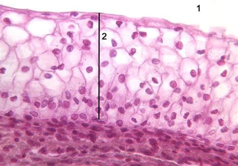 Epitelio estratificado características tipos función Celulas