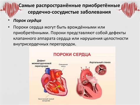 Заболевания сердечно-сосудистой системы и их предупреждение ...