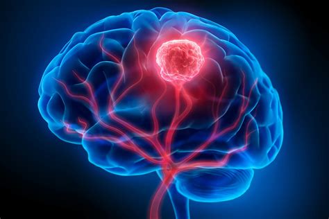 how to know if i have a tumor