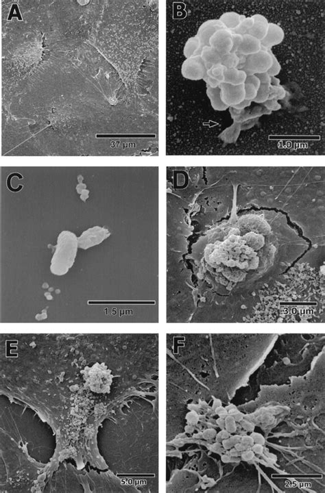 Transmission electron micrographs of bacteria internalized by CASMC ... 