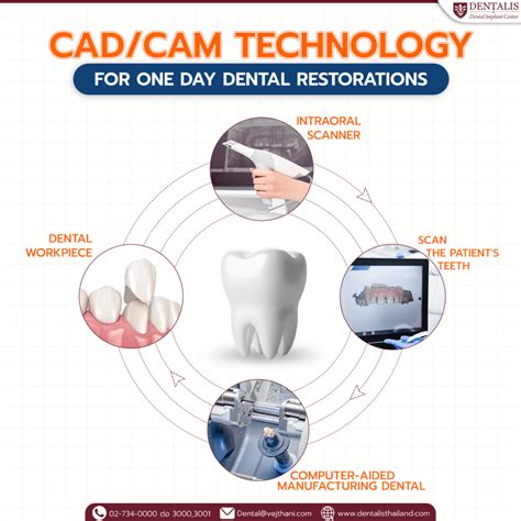 Cadcam Technology For One Day Dental Restorations Dentalisthailand