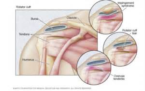 Water Polo Injuries 101: How to Identify and Heal Them