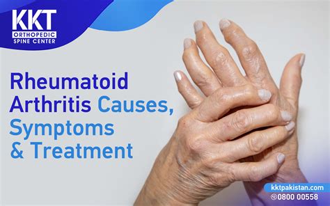 Rheumatoid Arthritis: Causes Symptoms & Treatment