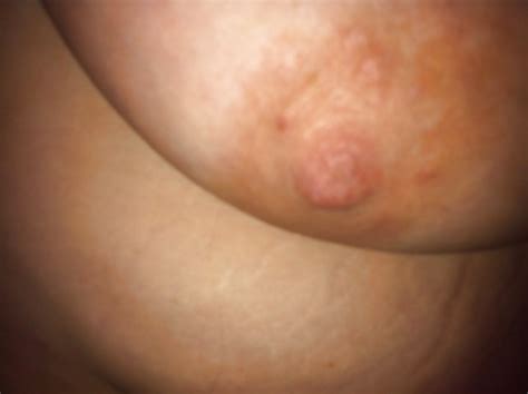 Another BBW Friend Porn Pictures XXX Photos Sex Images 233825 PICTOA