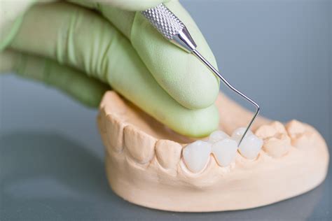 Différents Types de Prothèses Dentaires Clinique Dentaire Charles