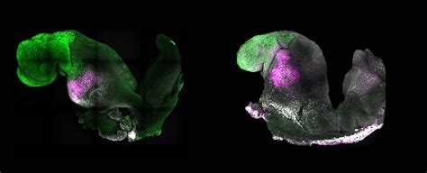 Scientists Grew A Synthetic Mouse Embryo With A Brain And A Beating