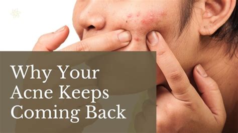 Why Your Acne Keeps Coming Back Eeva Medical Clinic