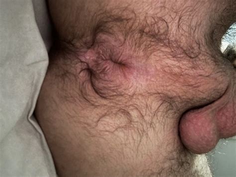 My Ass Hole Nude Pics Xhamster