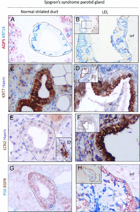 Expression Of Marker Suggestive Of Salivary Gland Progenitor And