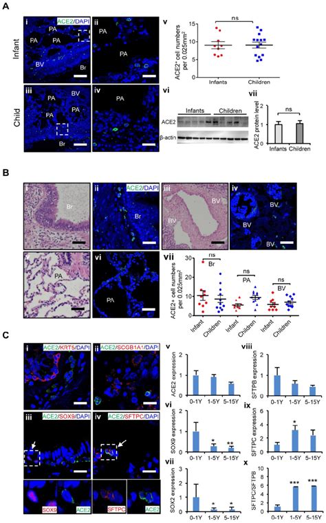 Characteristics Of Ace And Lung Progenitor Cells Distributed At