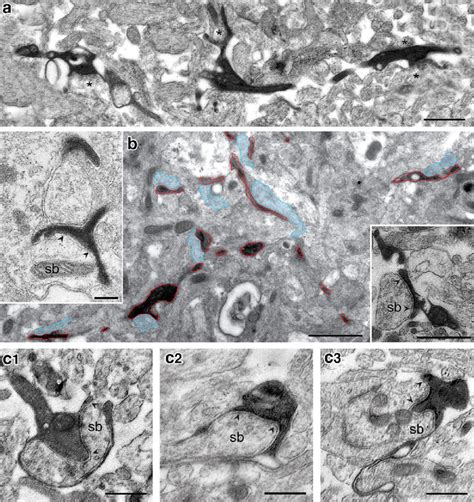 Synaptic Input To Cr Cells A Low Power Electron Micrograph Of The