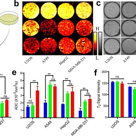 Specific Dwi Contrast Generated In Cells Transduced With Htert Aqp1 A