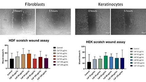 Figure A 1 Scratch Wound Assay Performed On Primary Fibroblasts Hdf Download Scientific