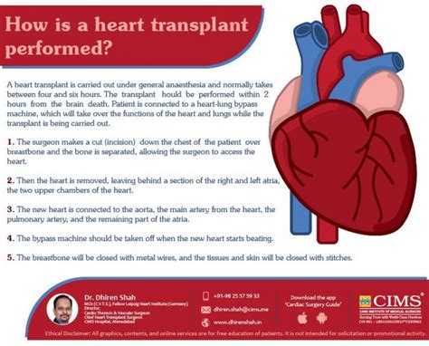 How Is A Heart Transplant Performed The Best Cardiac Surgeon In