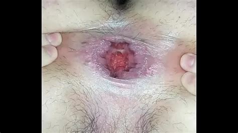 Perfect Pink Doodoo Hole Nude Pics XHamster