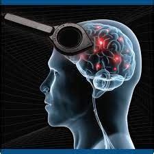 Non-invasive Brain Stimulation System Market Analysis, Challenges ...