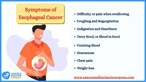 Esophageal Cancer Symptoms Causes Complications 56 Off