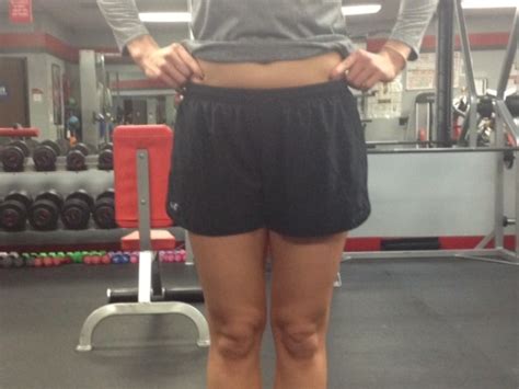 properly assessing leg length discrepancies  reddyorg